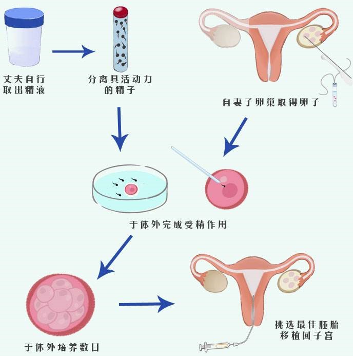 上海有哪些私立医院可以做供卵试管私立供卵试管成功经验分享