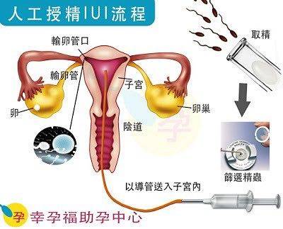 做供卵试管移植内膜68有多少成功率
