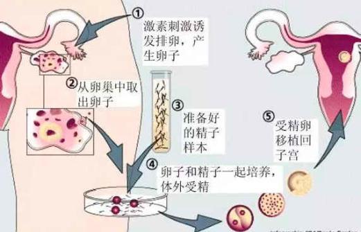 2024年国内哪家医院试管包生男孩婴儿贵不贵（试管怎样做才能省钱呢+）